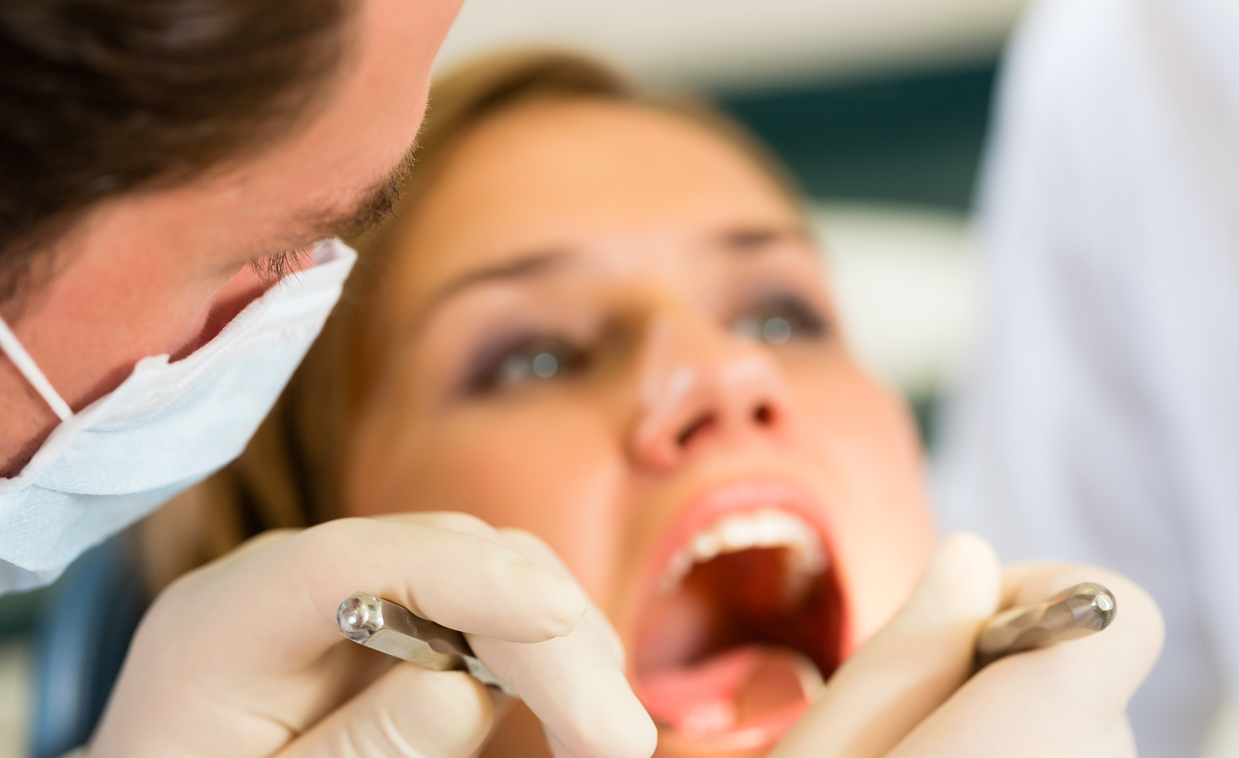 Fogkőeltávolítás kellemetlen szájszag ellen