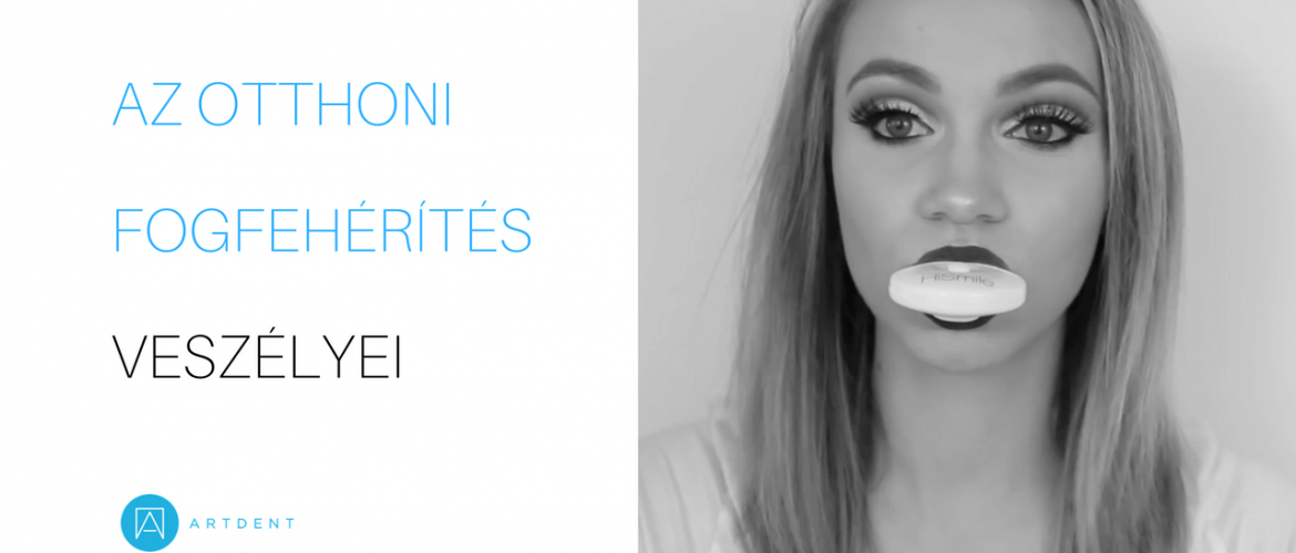 Egy fiatal nő otthoni fogfehérítés közben. A szályában egy fogfehérítésre alkalmas eszköz.