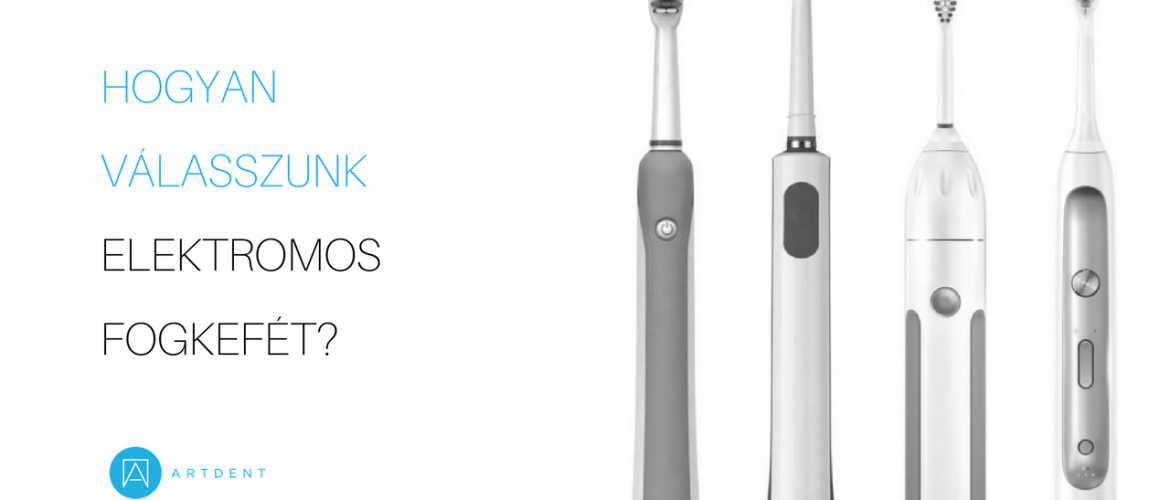 Hogyan válasszunk elektromos fogkefét borítókép