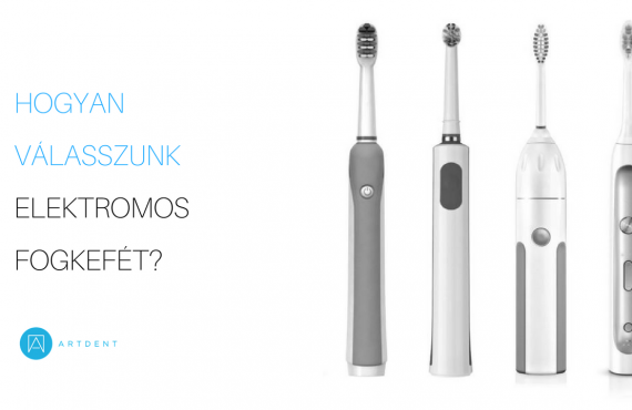 Hogyan válasszunk elektromos fogkefét borítókép