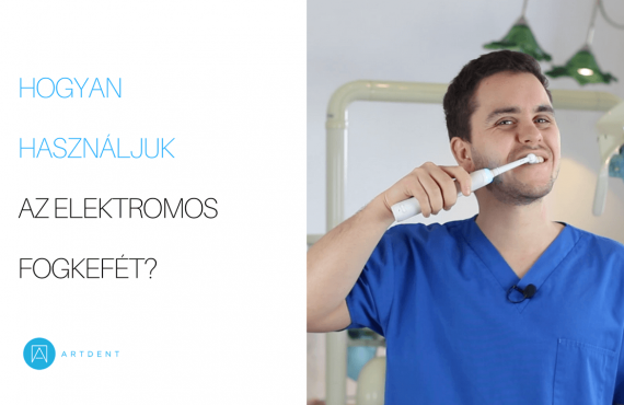 Hogyan használjuk az elektromos fogkefét borító