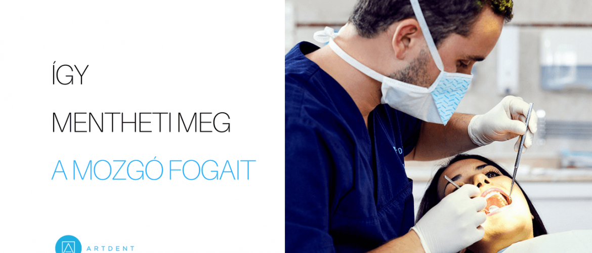 Így mentheti meg a mozgó fogait borító