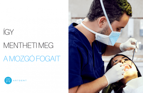 Így mentheti meg a mozgó fogait borító