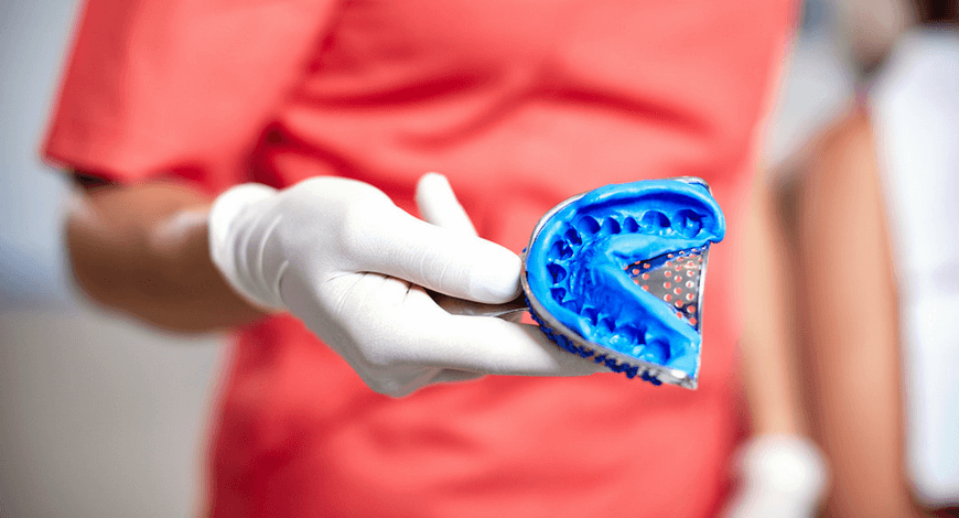 Dr. Friedreich Dóra, az Artdent fogszabályozó szakorvosa egy foglenyomatot tart a kezében a fogszabályozást megelőző vizsgálaton.