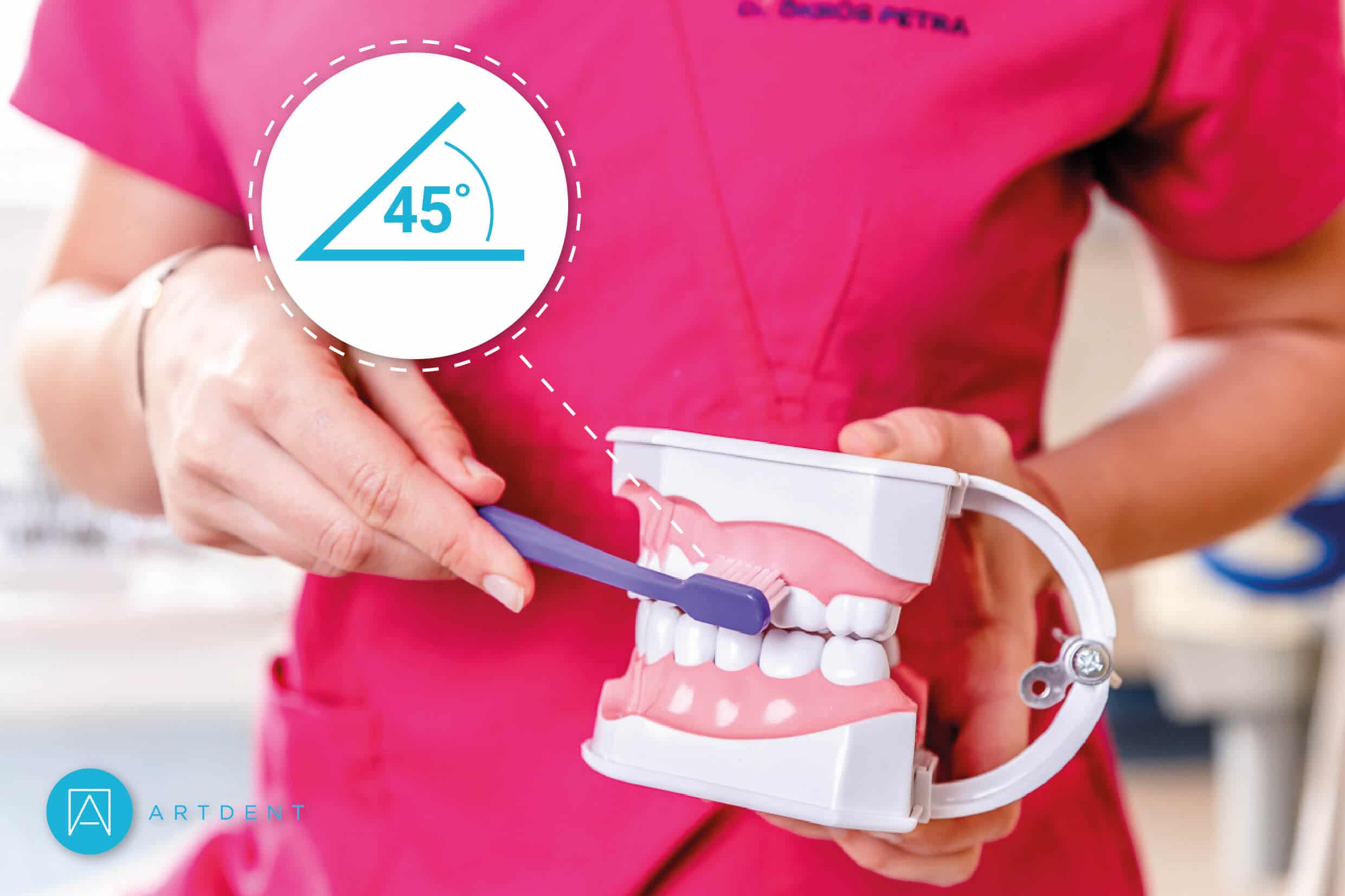 Fogmosási tippek az Artdent Fogászat tapasztalt fogorvosaitól - 45 fokos szögben tartott fogkefe