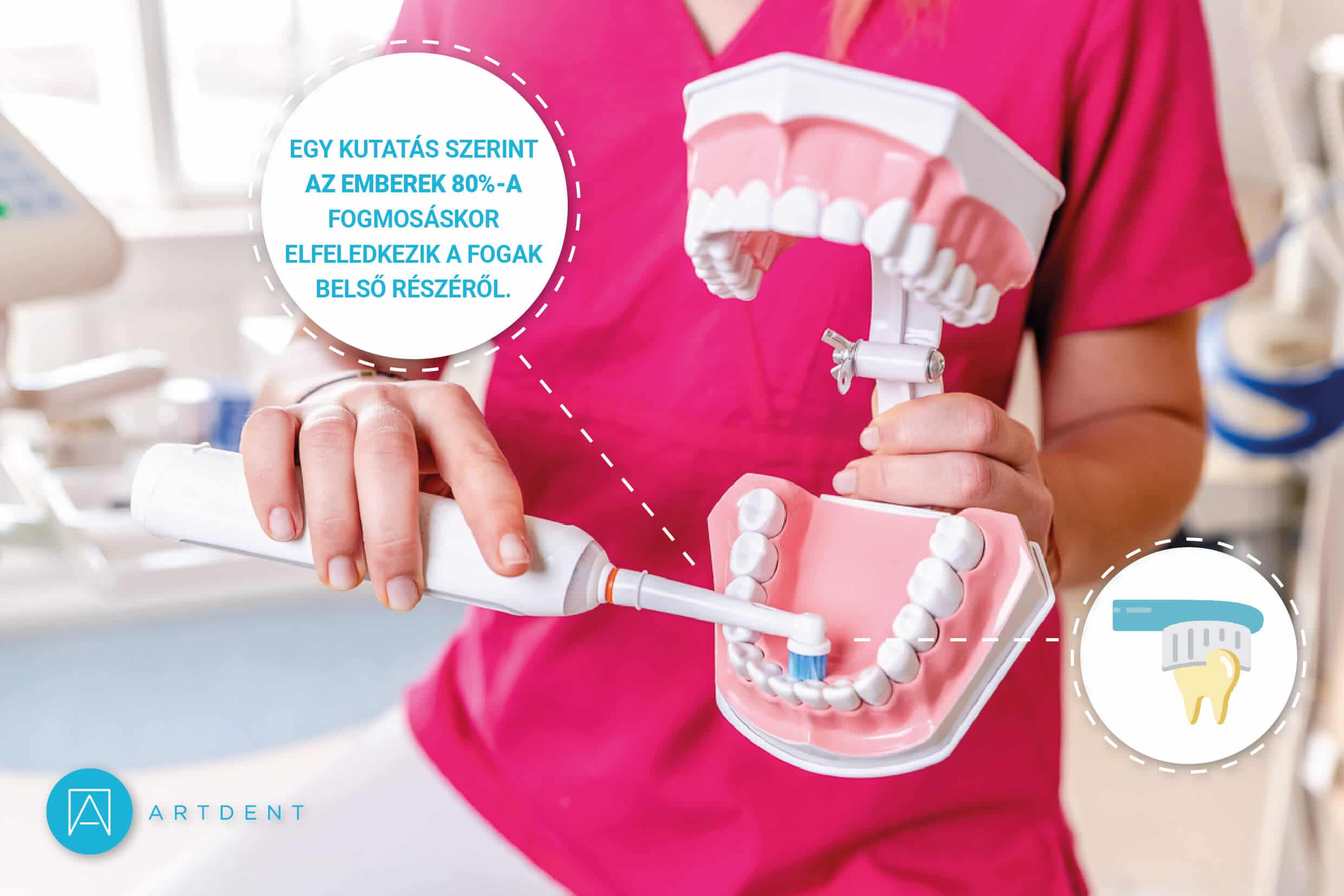 Dr. Ökrös Petra azt a területet mutatja amiről az emberek 80%-a elfeledkezik a fogmosás során.