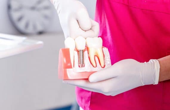 Dr. Ökrös Petra bemutatja az éjszakai fogszorítás hatásait.