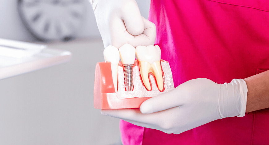 Dr. Ökrös Petra az éjszakai fogszorítás hatását mutatja be.