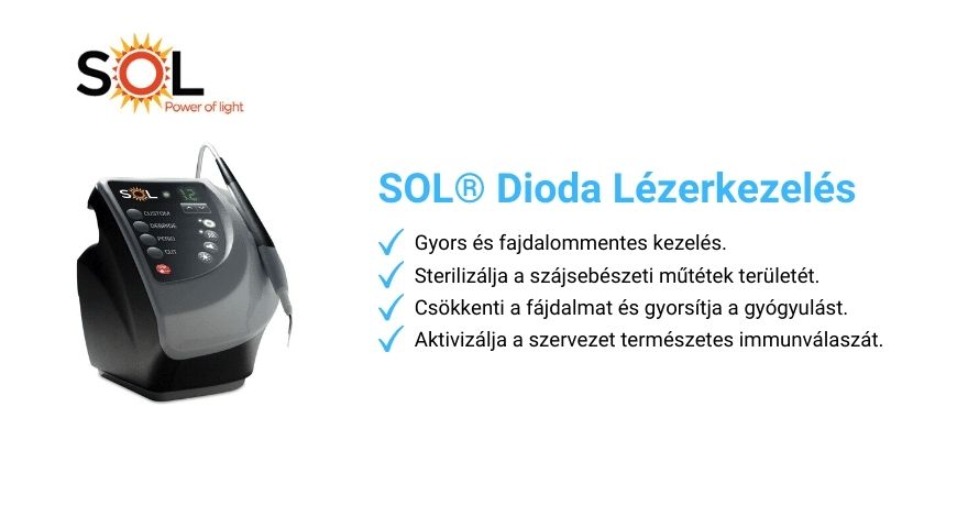 SOL dioda lézeres kezelés