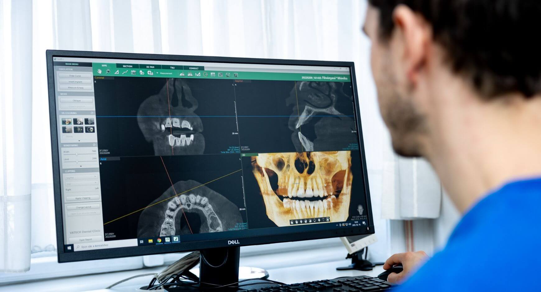 Az Artdent fogorvosa a fogászati CT-felvétel elemzése közben.