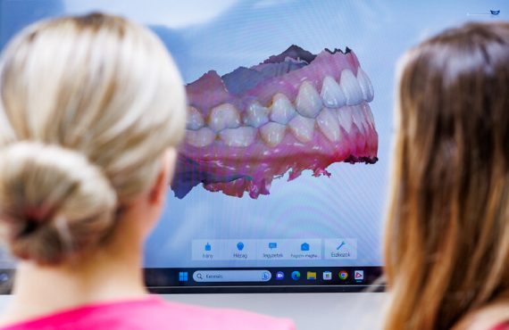 Az alsó vagy a felső fogíven kezdjük a fogmosást? Nem mindegy! (borító)