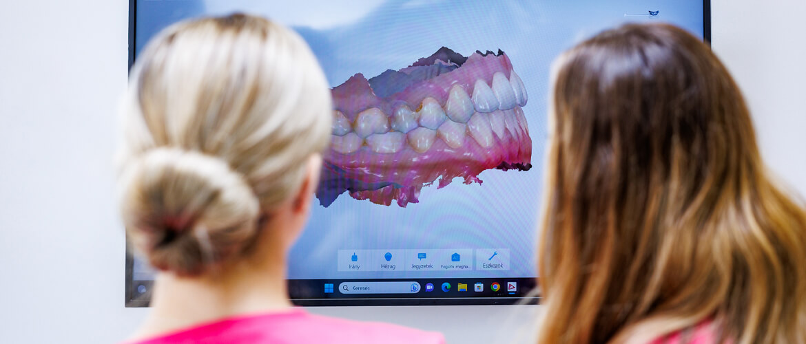 Az alsó vagy a felső fogíven kezdjük a fogmosást? Nem mindegy! (borító)