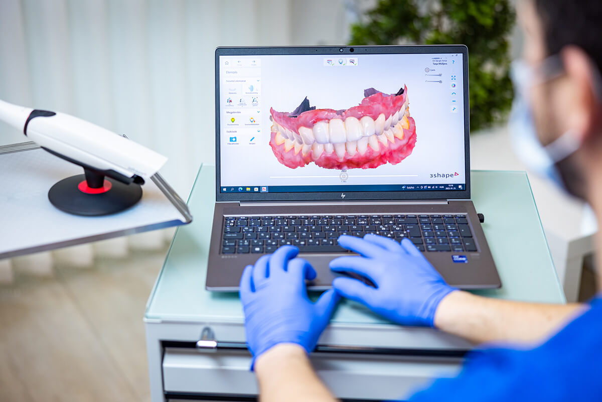 Artdent - Oral Scanner vizsgálat eredménye